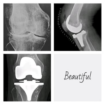Slider image (7) Dr. Rodrigo Aguirre Rojas Orthopedic Surgeon in Mexico